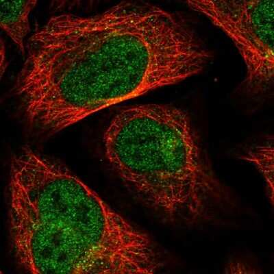 Immunocytochemistry/Immunofluorescence: MTFMT Antibody [NBP1-81871] - Immunofluorescent staining of human cell line U-2 OS shows localization to nucleoplasm & cytosol. Antibody staining is shown in green.