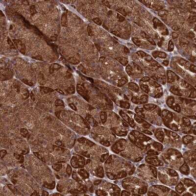 Immunohistochemistry-Paraffin: MTFMT Antibody [NBP1-81871] - Staining of human stomach, lower shows strong cytoplasmic positivity in glandular cells.