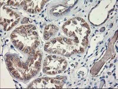 Immunohistochemistry: MTFMT Antibody (OTI1E7) - Azide and BSA Free [NBP2-72801] - Staining of paraffin-embedded Human Kidney tissue using anti-MTFMT mouse monoclonal antibody.