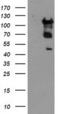 Western Blot: MTFMT Antibody (OTI1E7) - Azide and BSA Free [NBP2-72801] - HEK293T cells were transfected with the pCMV6-ENTRY control (Left lane) or pCMV6-ENTRY MTFMT (Right lane) cDNA for 48 hrs and lysed. Equivalent amounts of cell lysates (5 ug per lane) were separated by SDS-PAGE and immunoblotted with anti-MTFMT.