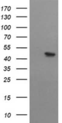 Western Blot: MTFMT Antibody (OTI2A2) - Azide and BSA Free [NBP2-72803] - Analysis of HEK293T cells were transfected with the pCMV6-ENTRY control (Left lane) or pCMV6-ENTRY MTFMT.