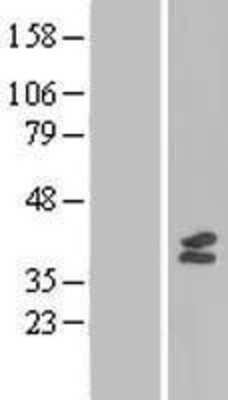 Western Blot: MTFMT Overexpression Lysate (Adult Normal) [NBL1-13361] Left-Empty vector transfected control cell lysate (HEK293 cell lysate); Right -Over-expression Lysate for MTFMT.