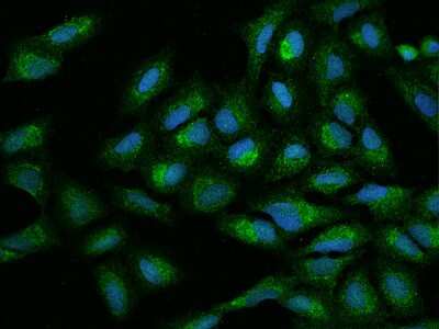 Immunocytochemistry/Immunofluorescence: MTG1 Antibody [NBP2-98486] - Immunofluorescence staining of MTG1 in U2OS cells. Cells were fixed with 4% PFA, permeabilzed with 0.1% Triton X-100 in PBS, blocked with 10% serum, and incubated with rabbit anti-Human MTG1 polyclonal antibody (dilution ratio 1:100) at 4C overnight. Then cells were stained with the Alexa Fluor(R)488-conjugated Goat Anti-rabbit IgG secondary antibody (green) and counterstained with DAPI (blue).Positive staining was localized to Cytoplasm.