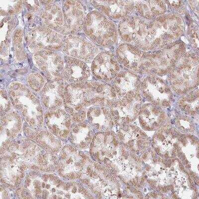 Immunohistochemistry: MTG1 Antibody [NBP2-46659] - Staining of human kidney shows moderate cytoplasmic positivity in cells in tubules.