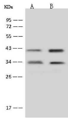 Western Blot: MTG1 Antibody [NBP2-98486] - Anti-MTG1 rabbit polyclonal antibody at 1:500 dilution. Lane A: Jurkat Whole Cell Lysate Lane B: U-251 MG Whole Cell Lysate Lysates/proteins at 30 ug per lane. Secondary Goat Anti-Rabbit IgG (H+L)/HRP at 1/10000 dilution. Developed using the ECL technique. Performed under reducing conditions. Predicted band size: 37 kDa. Observed band size: 33 kDa.