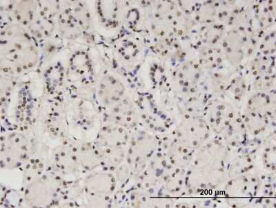 Immunohistochemistry-Paraffin: MTGR1 Antibody (2C10) [H00009139-M15] - Analysis of monoclonal antibody to CBFA2T2 on formalin-fixed paraffin-embedded human salivary gland. Antibody concentration 3 ug/ml