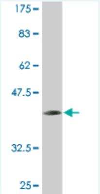 Western Blot: MTGR1 Antibody (2H8) [H00009139-M06] - Detection against Immunogen (37.18 KDa) .