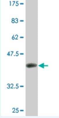 Western Blot: MTGR1 Antibody (3G8) [H00009139-M07] -  Detection against Immunogen (37.18 KDa) .