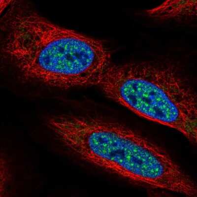 Immunocytochemistry/Immunofluorescence: MTGR1 Antibody [NBP2-56057] - Staining of human cell line U-2 OS shows localization to nuclear speckles.