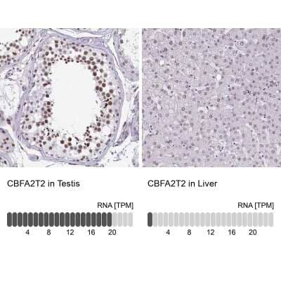 Immunohistochemistry-Paraffin: MTGR1 Antibody [NBP2-34136] - Staining in human testis and liver tissues using anti-CBFA2T2 antibody. Corresponding CBFA2T2 RNA-seq data are presented for the same tissues.