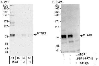 Immunoprecipitation: MTGR1 Antibody [NBP1-97748] - Samples:  Whole cell lysate from 293T (15 and 50 ug for WB; 1 mg for IP, 20% of IP loaded), Jurkat (J; 50 ug) and HeLa (H; 50 ug) cells.  Antibodies: Affinity purified rabbit anti-MTGR1 antibody NBP1-97748 used for WB at 0.1 ug/ml (A) and 1 ug/ml (B) and used for IP at 6 ug/mg lysate.  MTGR1  was also immunoprecipitated by rabbit anti-MTGR1 antibody, which recognizes an upstream epitope.   Detection: Chemiluminescence with exposure times of 3 minutes (A) and 30 seconds (B).