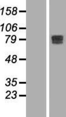 Western Blot: MTGR1 Overexpression Lysate (Adult Normal) [NBL1-08734] Left-Empty vector transfected control cell lysate (HEK293 cell lysate); Right -Over-expression Lysate for MTGR1.