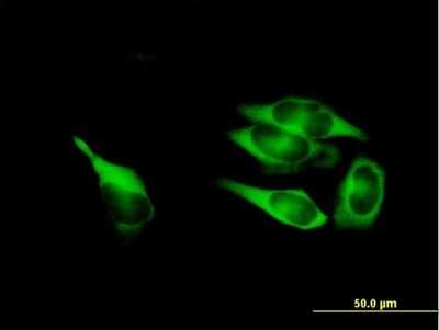 Immunocytochemistry/Immunofluorescence: MTHFD1 Antibody [H00004522-B01P] - Analysis of purified antibody to MTHFD1 on HeLa cell. (antibody concentration 10 ug/ml)