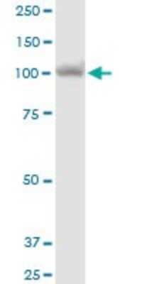 Western Blot: MTHFD1 Antibody [H00004522-B01P] - Analysis of MTHFD1 expression in HeLa.
