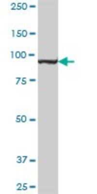 Western Blot: MTHFD1 Antibody [H00004522-B01P] - Analysis of MTHFD1 expression in human placenta.