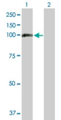 Western Blot: MTHFD1 Antibody [H00004522-B01P] - Analysis of MTHFD1 expression in transfected 293T cell line by MTHFD1 polyclonal antibody.  Lane1:MTHFD1 transfected lysate(102.85 KDa). Lane2:Non-transfected lysate.