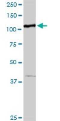 Western Blot: MTHFD1 Antibody [H00004522-D01P] - Analysis of MTHFD1 expression in mouse liver.