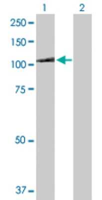 Western Blot: MTHFD1 Antibody [H00004522-D01P] - Analysis of MTHFD1 expression in transfected 293T cell line by MTHFD1 polyclonal antibody.Lane 1: MTHFD1 transfected lysate(101.60 KDa).Lane 2: Non-transfected lysate.