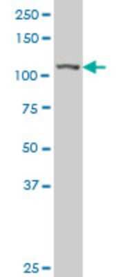 Western Blot: MTHFD1L Antibody [H00025902-A01] - Analysis of MTHFD1L expression in 293 (Cat # L026V1).