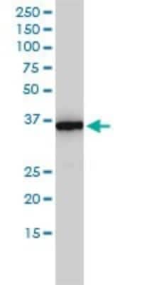 Western Blot: MTHFD2 Antibody (4G7-2G3) [H00010797-M01] - MTHFD2 monoclonal antibody (M01), clone 4G7-2G3 Analysis of MTHFD2 expression in HepG2.