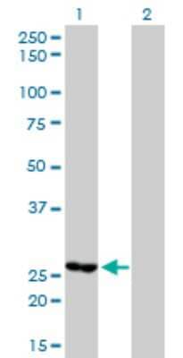 Western Blot: MTHFD2 Antibody (4G7-2G3) [H00010797-M01] - Analysis of MTHFD2 expression in transfected 293T cell line by MTHFD2 monoclonal antibody (M01), clone 4G7-2G3.Lane 1: MTHFD2 transfected lysate(26.8 KDa).Lane 2: Non-transfected lysate.