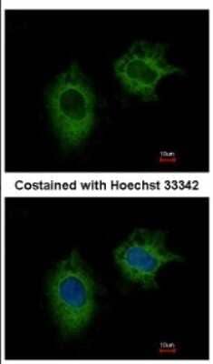 Immunocytochemistry/Immunofluorescence: MTHFD2 Antibody [NBP2-19429] - Immunofluorescence analysis of methanol-fixed HeLa, using antibody at 1:500 dilution.