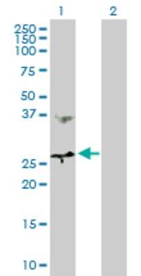Western Blot: MTHFD2 Antibody [H00010797-D01P] - Analysis of MTHFD2 expression in transfected 293T cell line by MTHFD2 polyclonal antibody.Lane 1: MTHFD2 transfected lysate(26.80 KDa).Lane 2: Non-transfected lysate.