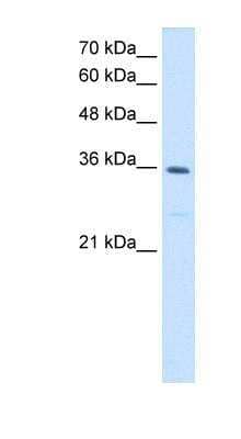 Western Blot: MTHFD2 Antibody [NBP1-54655] - HepG2 cell lysate, concentration 1.25ug/ml.