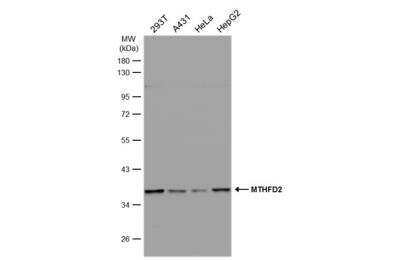 Western Blot: MTHFD2 Antibody [NBP2-19429] - Various whole cell extracts (30 ug) were separated by 10% SDS-PAGE, and the membrane was blotted with MTHFD2 antibody diluted at 1:1000. HRP-conjugated anti-rabbit IgG antibody was used to detect the primary antibody.