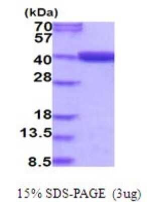 SDS-Page: Recombinant Human MTHFD2 Protein [NBP2-51979] - 15% SDS Page (3 ug)