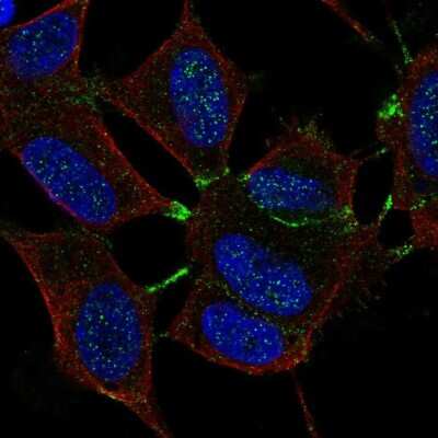 Immunocytochemistry/Immunofluorescence: MTHFR Antibody [NBP2-55974] - Staining of human cell line SH-SY5Y shows localization to cell junctions.