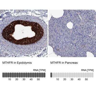 <b>Orthogonal Strategies Validation. </b>Immunohistochemistry-Paraffin: MTHFR Antibody [NBP3-17040] - Analysis in human epididymis and pancreas tissues using Anti-MTHFR antibody. Corresponding MTHFR RNA-seq data are presented for the same tissues.