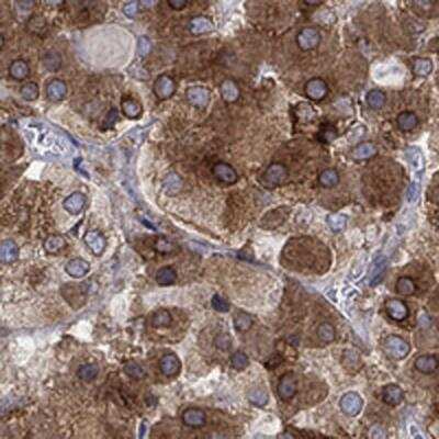 Immunohistochemistry-Paraffin: MTHFR Antibody [NBP3-17040] - Staining of human piuitary gland shows strong positivity in cells in anterior.