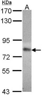 Western Blot: MTHFR Antibody [NBP1-33530] - Sample (30 ug of whole cell lysate) A: 293T 7. 5% SDS PAGE; antibody diluted at 1:1000.