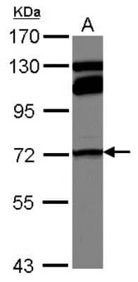 Western Blot: MTHFR Antibody [NBP2-19430] - Sample (30 ug of whole cell lysate) A: A549 7. 5% SDS PAGE gel, diluted at 1:1000.