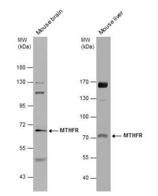 Western Blot: MTHFR Antibody [NBP2-19430] - Various tissue extracts (50 ug) were separated by 7.5% SDS-PAGE, and the membrane was blotted with MTHFR antibody [N3C3] diluted at 1:1000. The HRP-conjugated anti-rabbit IgG antibody (NBP2-19301) was used to detect the primary antibody.