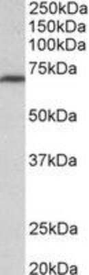 Western Blot: MTHFR Antibody [NBP2-27549] - (0.3 ug/ml) staining of NIH3T3 lysate (35 ug protein in RIPA buffer). Primary incubation was 1 hour. Detected by chemiluminescence.