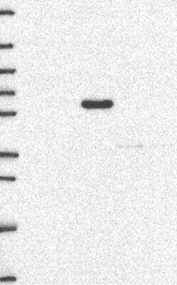 Western Blot: MTHFR Antibody [NBP3-17040] - Lane 1: Marker [kDa] 250, 130, 95, 72, 55, 36, 28, 17, 10 | Lane 2: RT4 | Lane 3: U-251 MG | Lane 4: Human Plasma | Lane 5: Liver | Lane 6: Tonsil