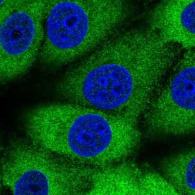Immunocytochemistry/Immunofluorescence: MTHFS Antibody [NBP2-58656] - Staining of human cell line MCF7 shows localization to cytosol.