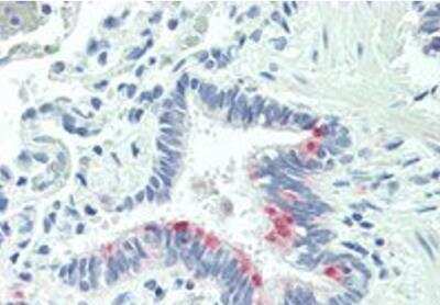 Immunohistochemistry-Paraffin: MTHFS Antibody [NBP1-20947] - Staining of paraffin embedded Human Lung at dilution of 5ug/ml. Steamed antigen retrieval with citrate buffer pH 6, AP-staining.