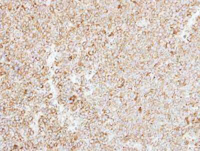 Immunohistochemistry-Paraffin: MTHFS Antibody [NBP2-19431] - Immunohistochemical analysis of paraffin-embedded AGS xenograft, using antibody at 1:250 dilution.