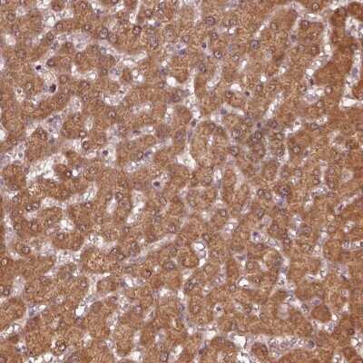Immunohistochemistry-Paraffin: MTHFS Antibody [NBP2-58656] - Immunohistochemical staining of human liver shows moderate cytoplasmic positivity in hepatocytes.