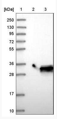 Western Blot: MTHFS Antibody [NBP1-83161] - Lane 1: Marker [kDa] 250, 130, 95, 72, 55, 36, 28, 17, 10 Lane 2: Negative control (vector only transfected HEK293T lysate) Lane 3: Over-expression lysate (Co-expressed with a C-terminal myc-DDK tag (~3.1 kDa) in mammalian HEK293T cells, LY416629)