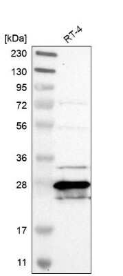Western Blot: MTHFS Antibody [NBP1-83161] - Analysis in human cell line RT-4.