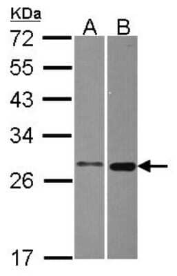 Western Blot: MTHFS Antibody [NBP2-19431] - Sample (30 ug of whole cell lysate) A: A549 B: Hep G2 12% SDS PAGE gel, diluted at 1:1000.