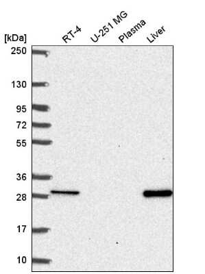 Western Blot: MTHFS Antibody [NBP2-58656] - Western blot analysis in human cell line RT-4, human cell line U-251 MG, human plasma and human liver tissue.