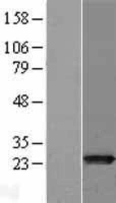 Western Blot: MTHFS Overexpression Lysate (Adult Normal) [NBL1-13366] Left-Empty vector transfected control cell lysate (HEK293 cell lysate); Right -Over-expression Lysate for MTHFS.