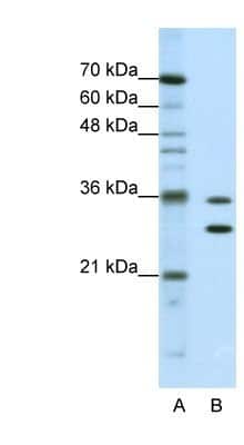 Western Blot: MTHFSD Antibody [NBP1-80462] - Jurkat cell lysate, Antibody Titration: 0.625ug/ml