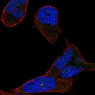 Immunocytochemistry/Immunofluorescence: MTMR1 Antibody [NBP2-58274] - Staining of human cell line RH-30 shows localization to microtubule organizing center.