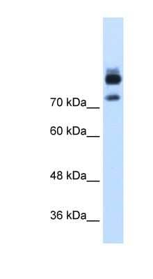 Western Blot: MTMR1 Antibody [NBP1-55486] - Titration: 1.25ug/ml Positive Control: HepG2 cell lysate.